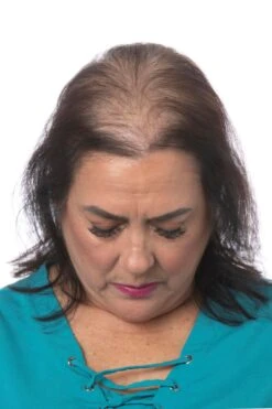 Perfect Topper By Toni Brattin | Heat-Friendly Synthetic -Exquisite Wig Shop TB PerfectTopper Product3 Before